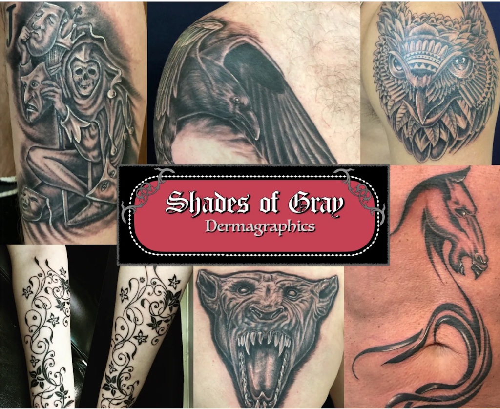 Shades of Gray Dermagraphics