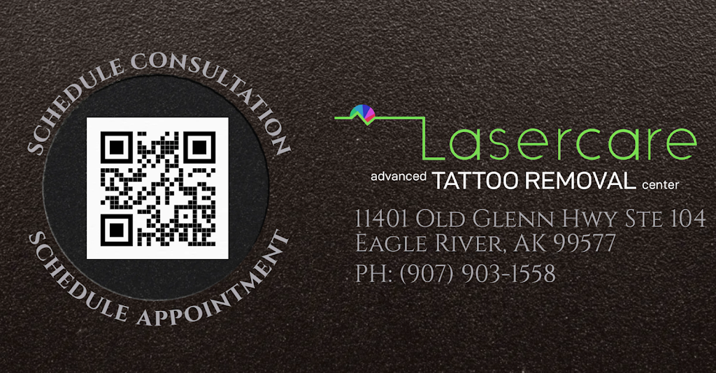 Lasercare Tattoo Removal