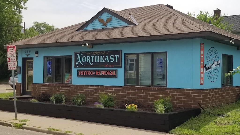 Northeast Tattoo & Fade Away Laser Tattoo Removal